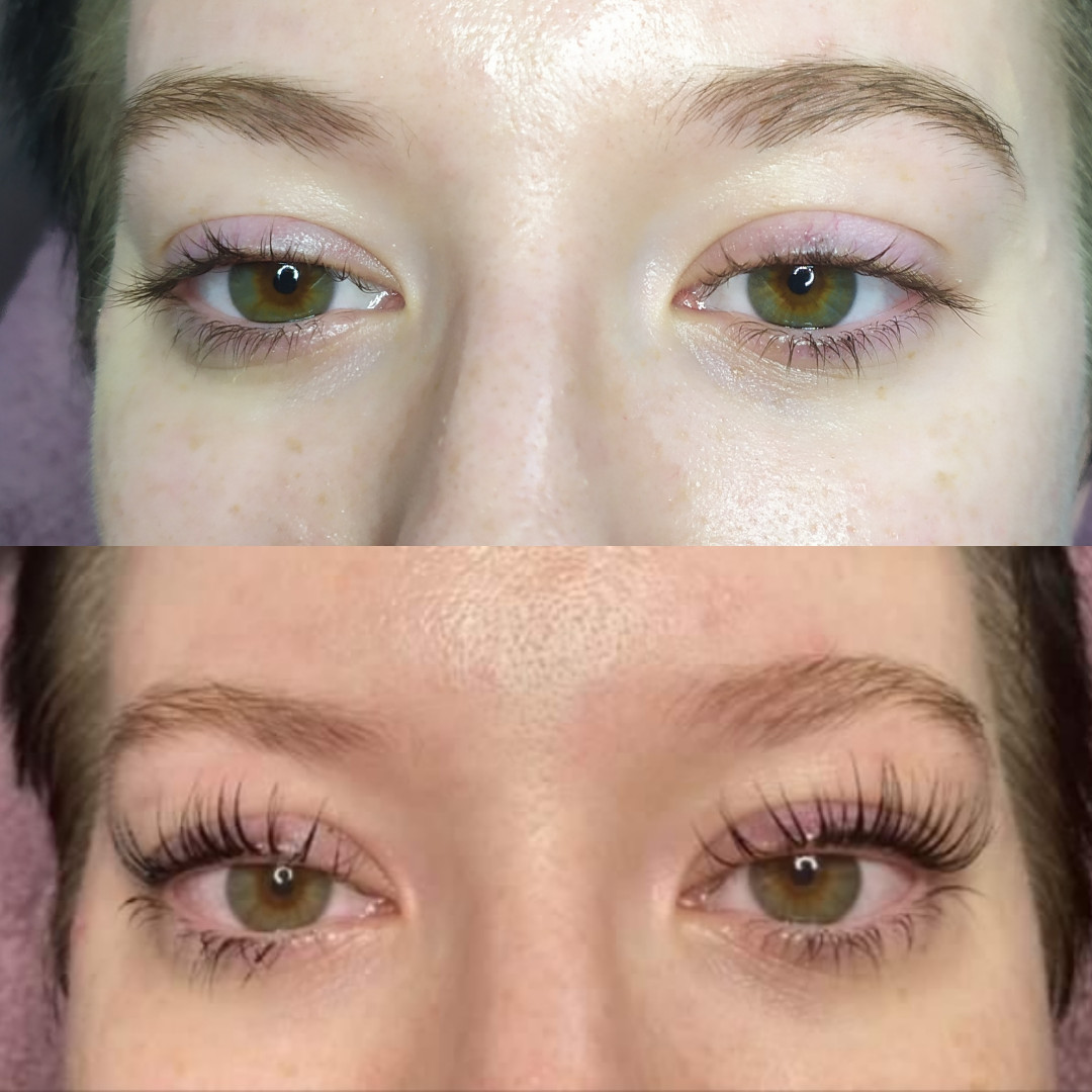 Factor Estetic #beograd Trepavice