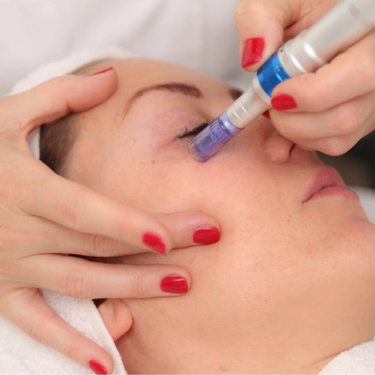 Ritual face and body #beograd Dermaroler i dermapen Dermapen tretman najdelotvornija metoda podmladj
