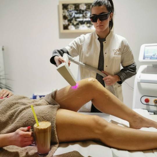 D&D Beauty Center #beograd Laserska epilacija Laserska epilacija celih nogu - za dame
