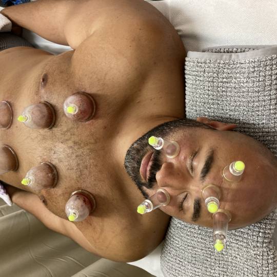 Hidžama Centar Beograd #beograd Alternativna medicina Hidžama