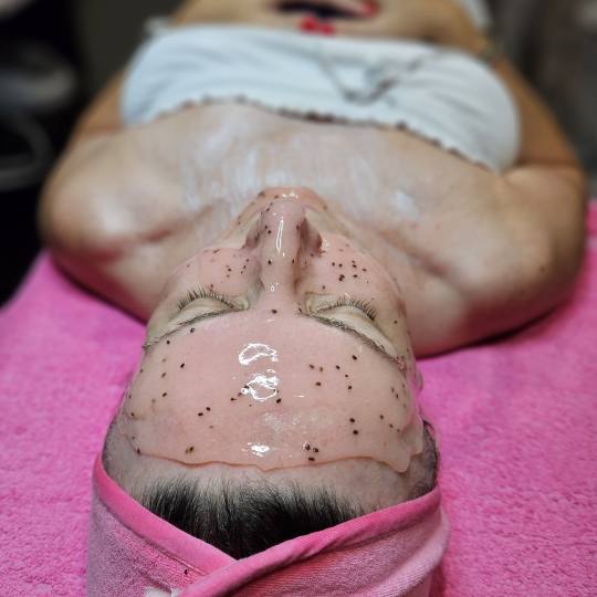 Starmedic #beograd Tretman lica Hidratacija kože - tretman lica