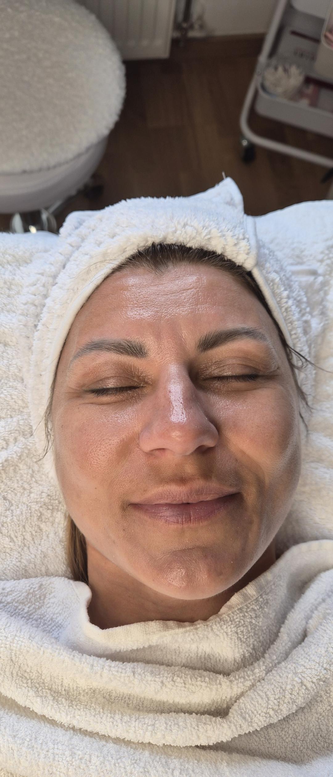 Miolift lica+radiotalsni lifting - Oladoria Rituals, Novi Sad Tretman lica Lice Tretman lica, Novi Sad, Sajmište, Detelinara, Banatić