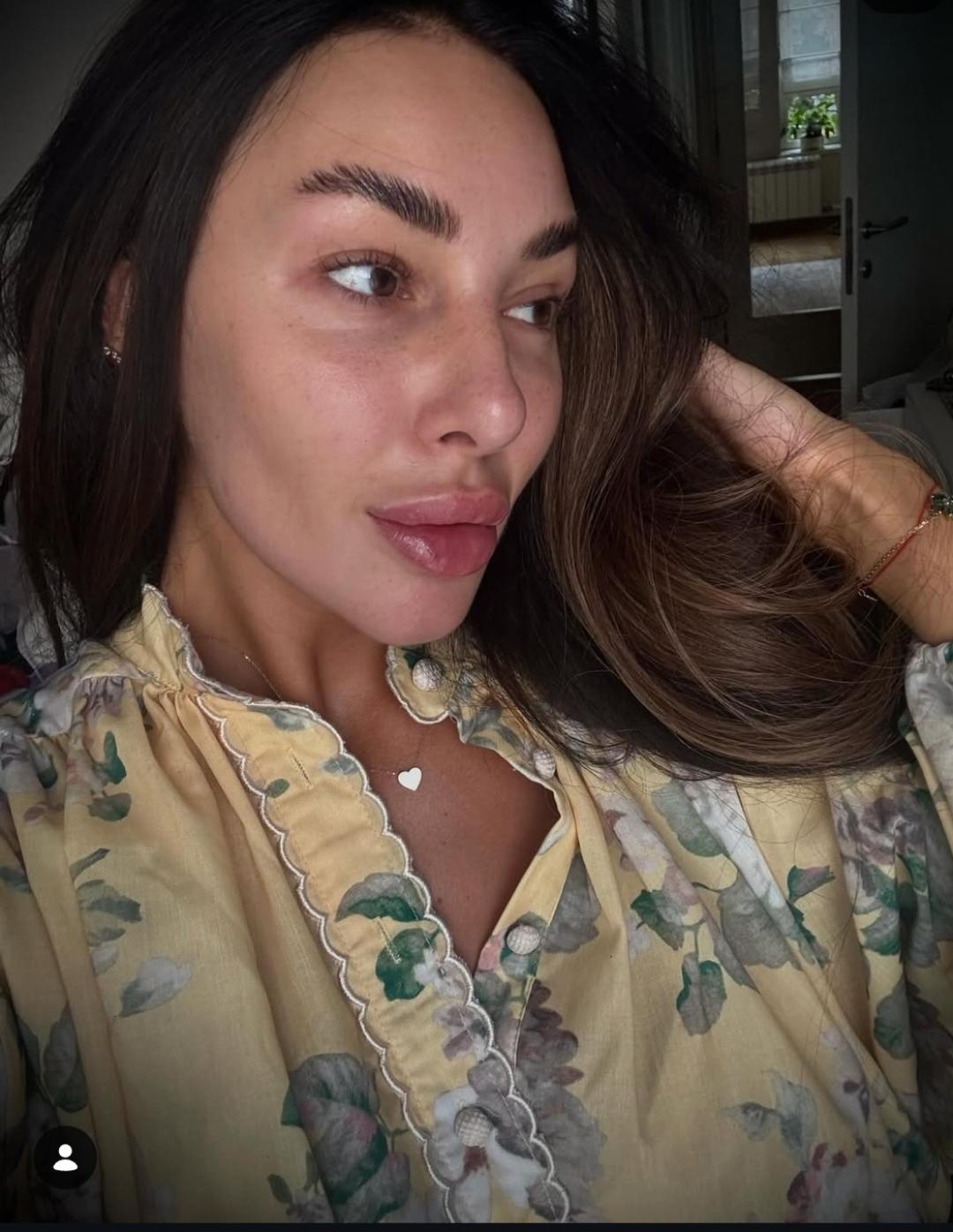 Choco Love #beograd Tretman lica Microneedling tretman