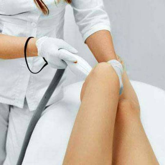 Ordinacija Epil Medic #beograd Laserska epilacija Laserska epilacija celih nogu - za dame Laserska e