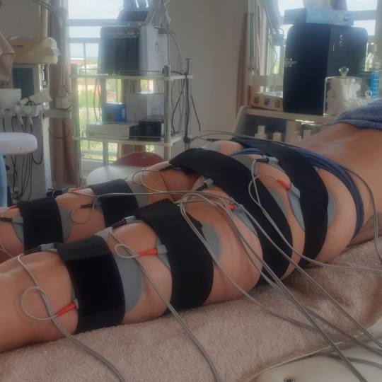 Pro Beauty Team #beograd Elektrostimulacija mišića Elektrostimulacija mišića
