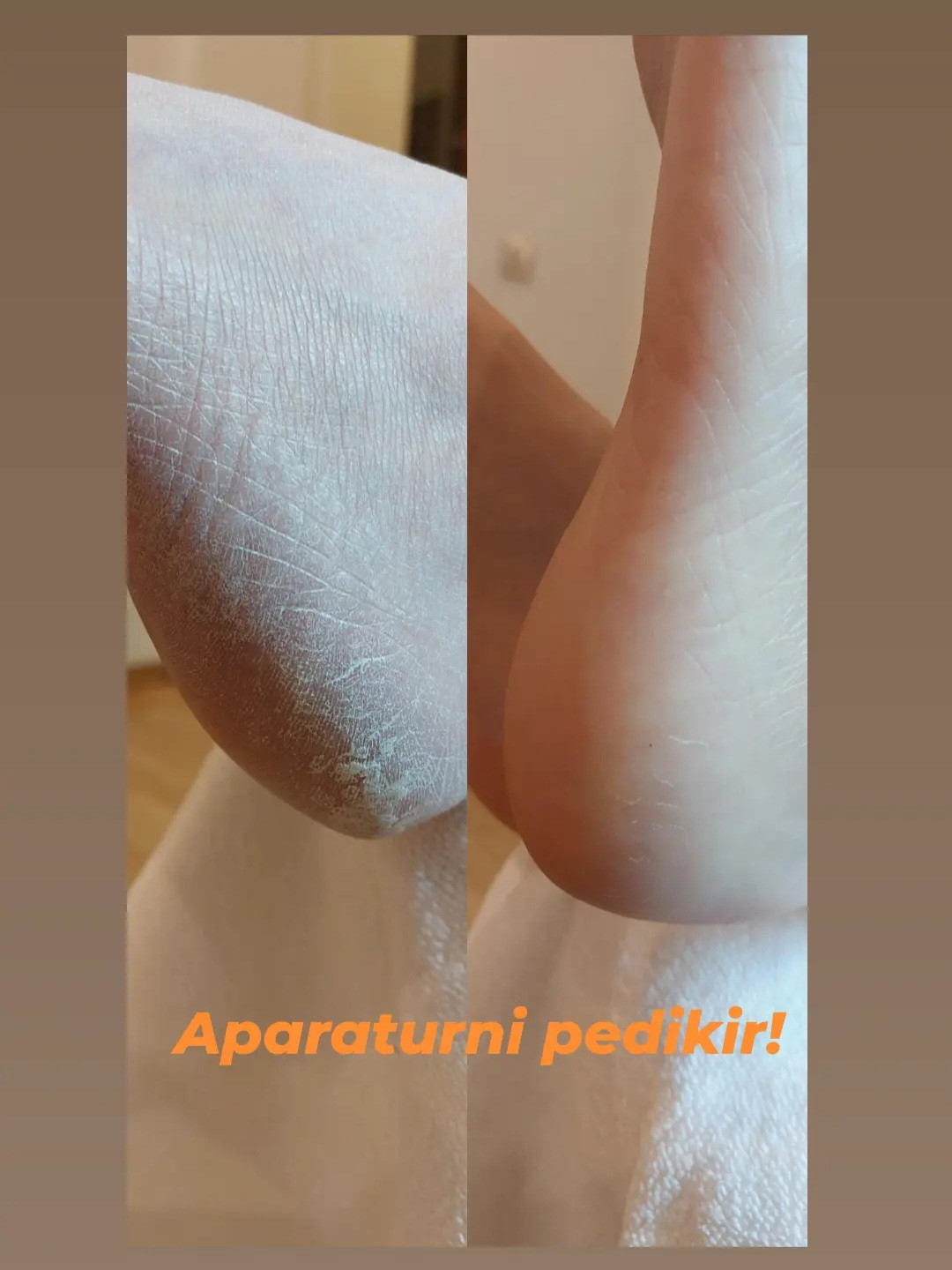 Viva Derm #beograd Estetski pedikir Estetski pedikir klasičan/aparaturni