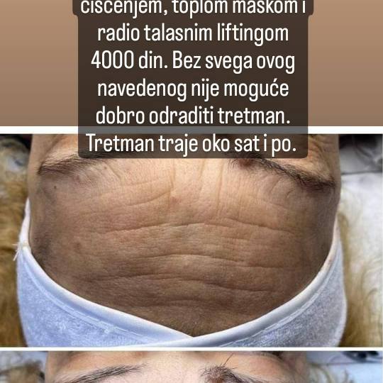 Ceragem Relax #krusevac Tretman lica Kolagen niti - lice