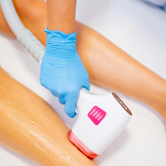 Monika Barta Cosmetics - Subotica #subotica Laserska epilacija Laserska epilacija celih nogu + prsti