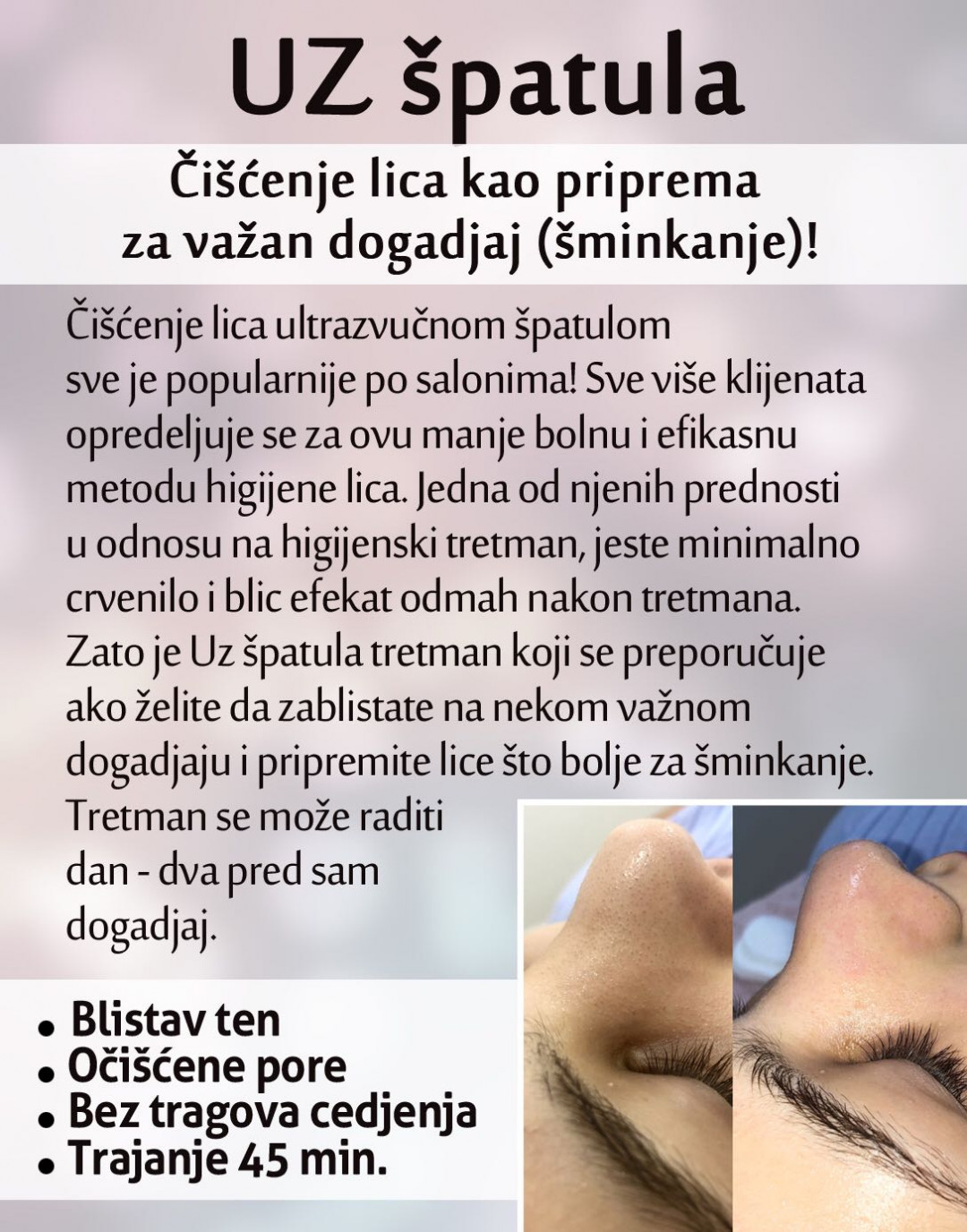 Čišćenje lica ultrazvučnom špatulom - Makeup Olja Grbić, Novi Sad Tretman lica Lice Tretman lica, Novi Sad, Rotkvarija, Podbara, Salajka