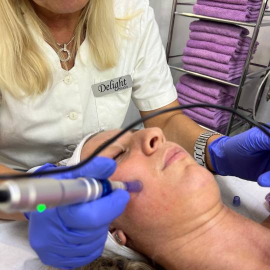 Laser centar Delight #beograd Piling lica Dermapen – mikronidling tretman Dermapen je aparat koji 