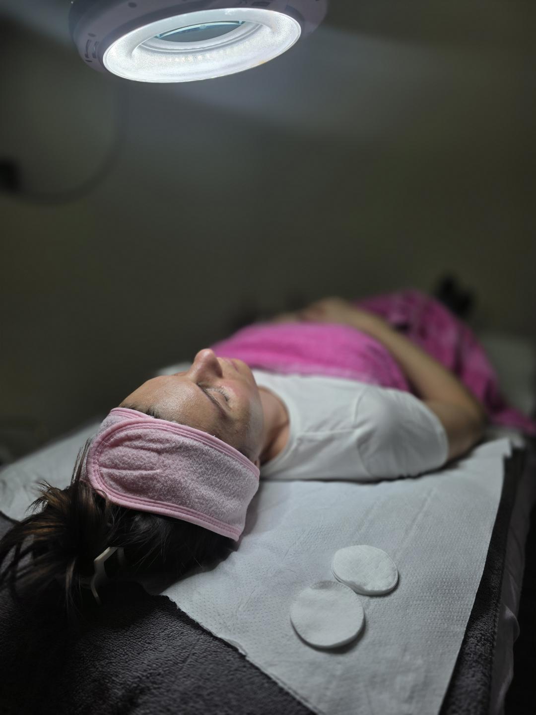 Dermapen tretman lica - Starmedic, Beograd Dermaroler i dermapen Lice Dermaroler i dermapen, Beograd, Vračar, Čubura, Crveni krst