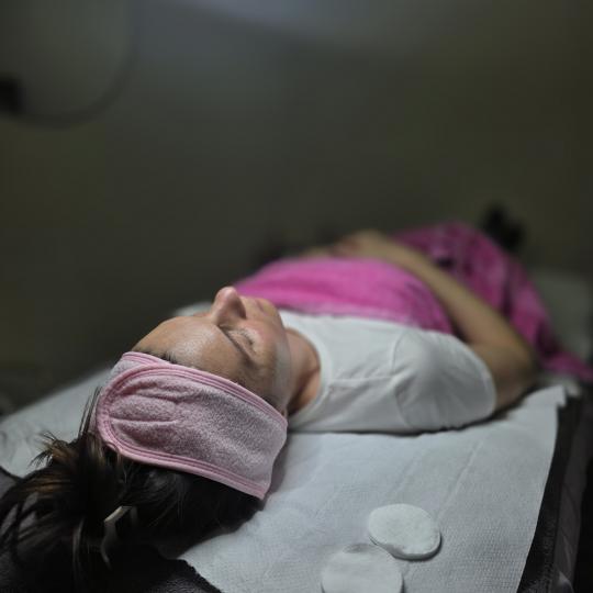 Starmedic #beograd Dermaroler i dermapen Dermapen tretman lica