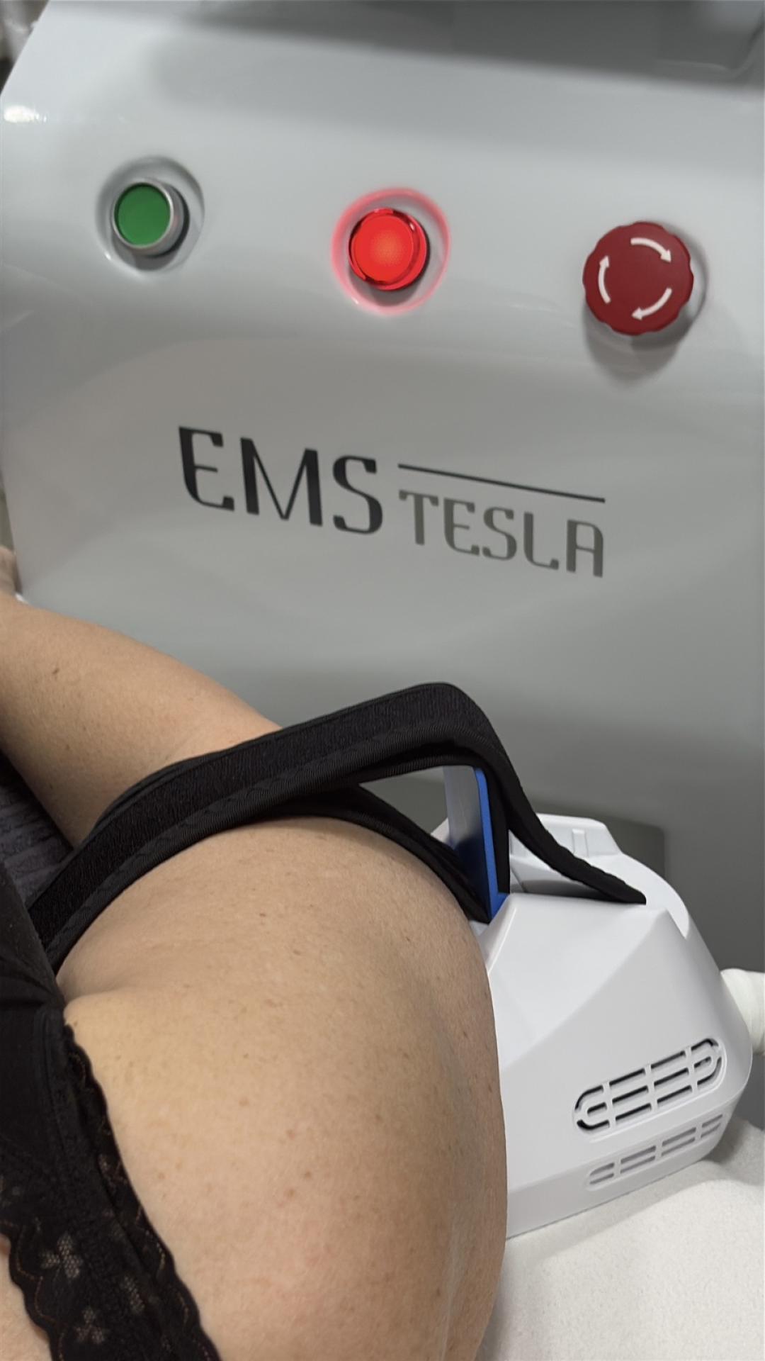 Estetik MPL 87 #beograd Tretmani tela EMS Tesla tretman tela