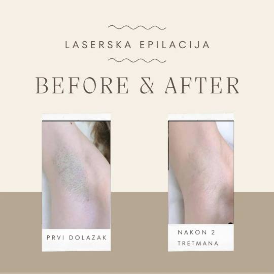 Vanilla rain beauty usluga