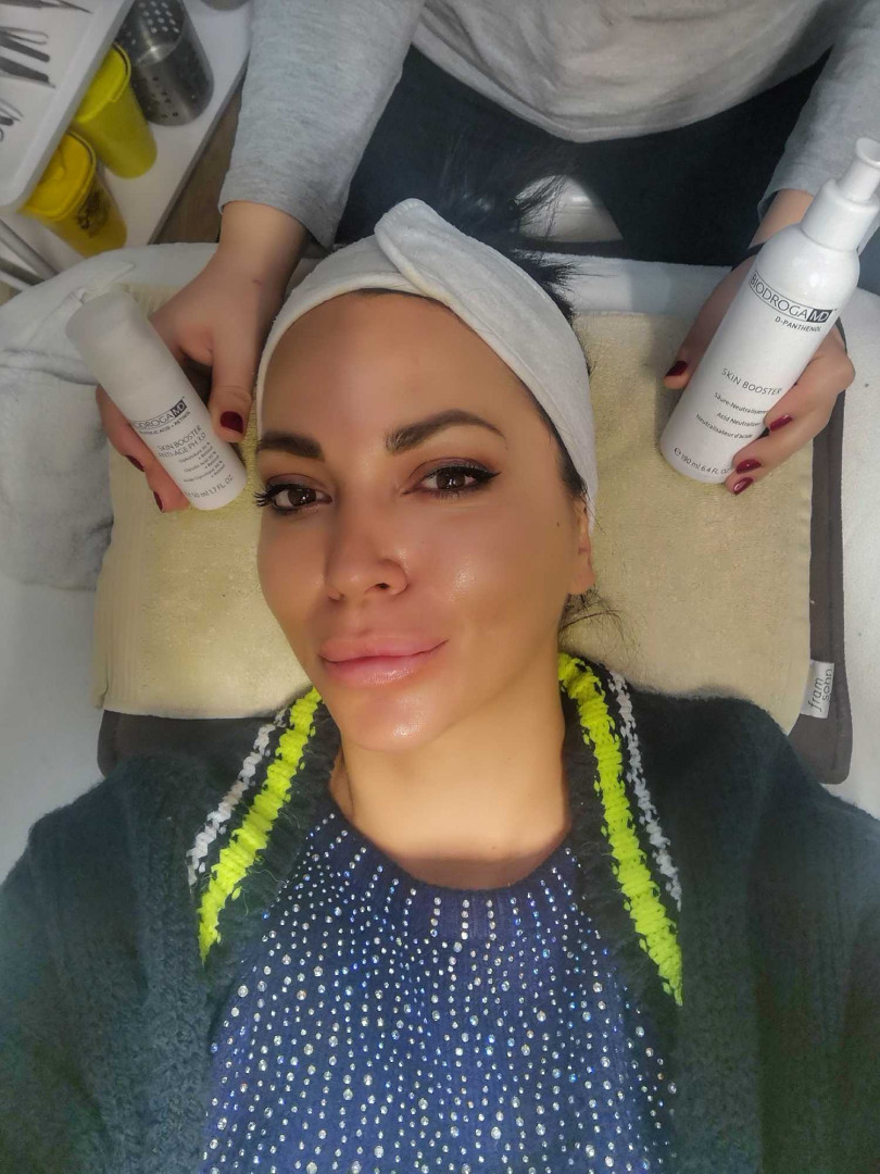 Bibi beauty centar #beograd Piling lica Tretman lica voćnim kiselinama