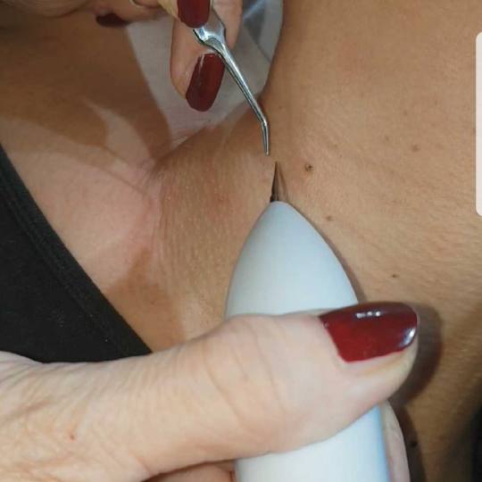 Grossi cosmetic #beograd Tretman lica
