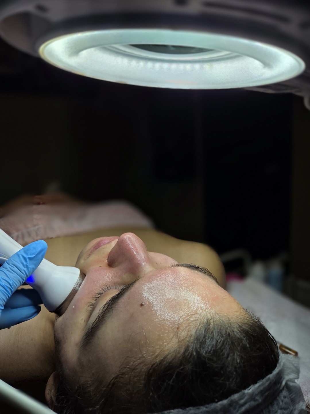 Starmedic #beograd Tretman lica Hydrafacial - tretman lica 5 u 1