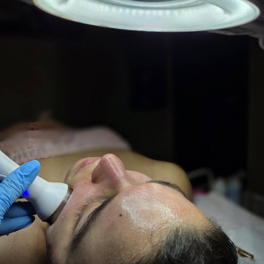 Starmedic #beograd Tretman lica Hydrafacial - tretman lica 5 u 1