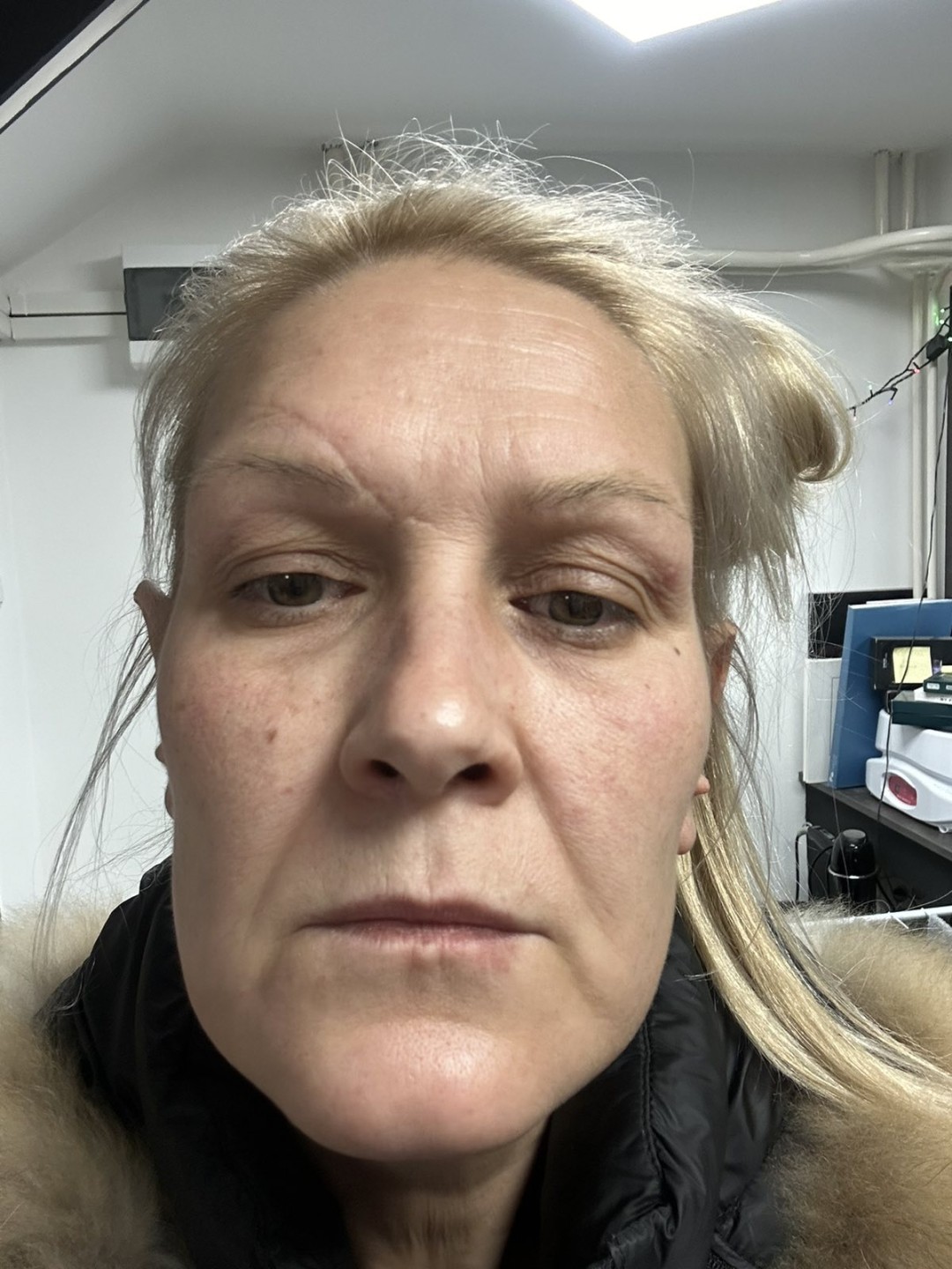 Andre Art #nis Tretman lica Aparatni face lifting tretman - za podizanje tonusa + umanjenje bora
