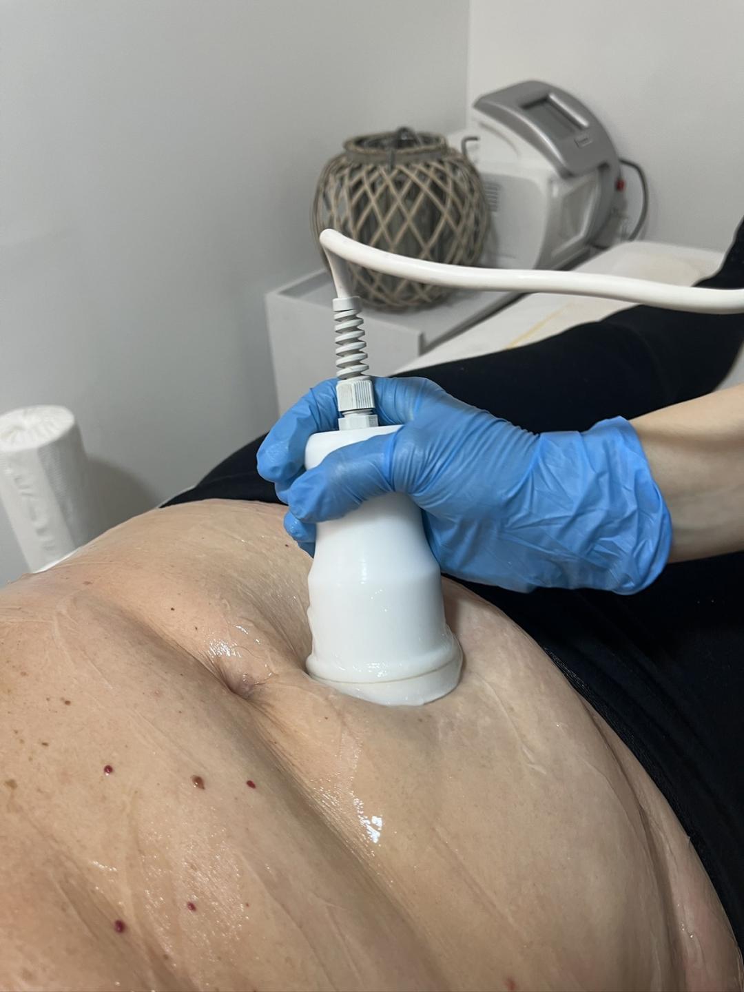 Estetik MPL 87 #beograd