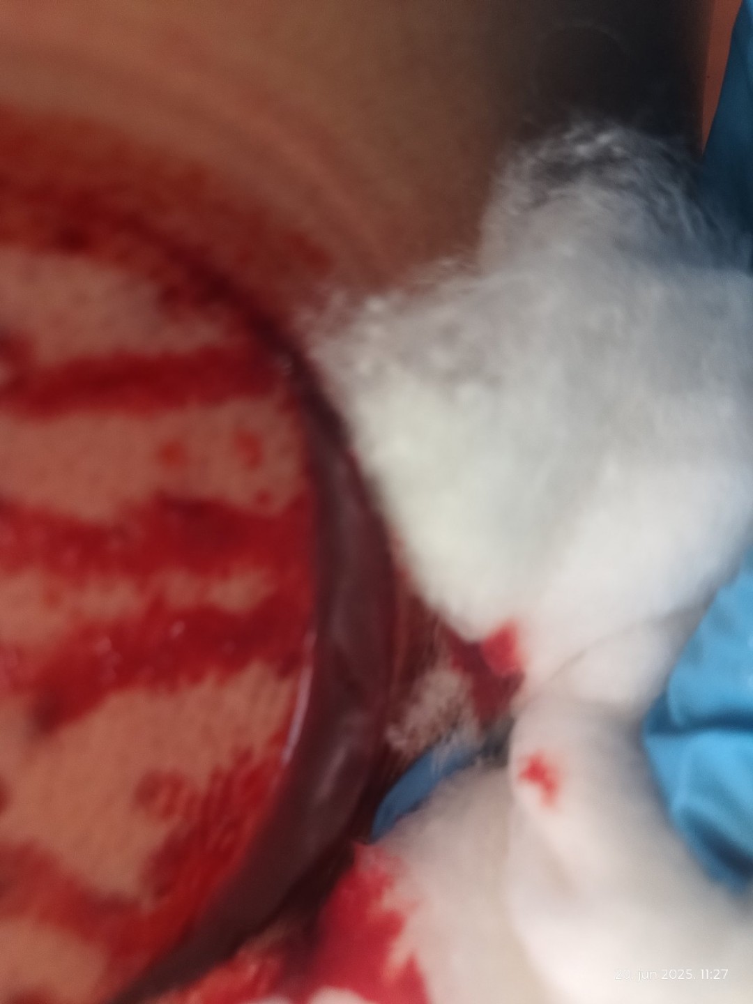 Relax body centar #zajecar Masaža teglama Mokra hidžama