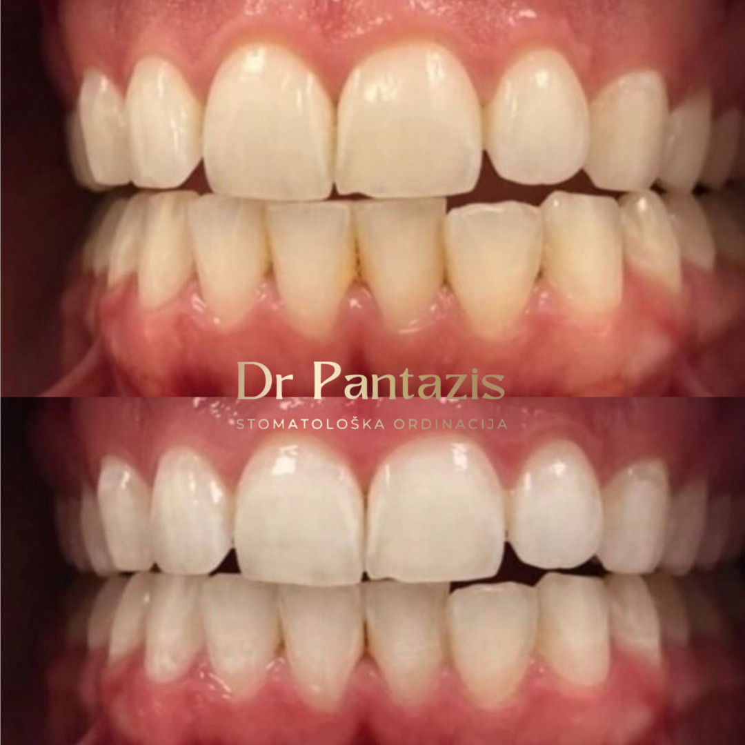 Dr Pantazis - Dental & Beauty Clinic #beograd