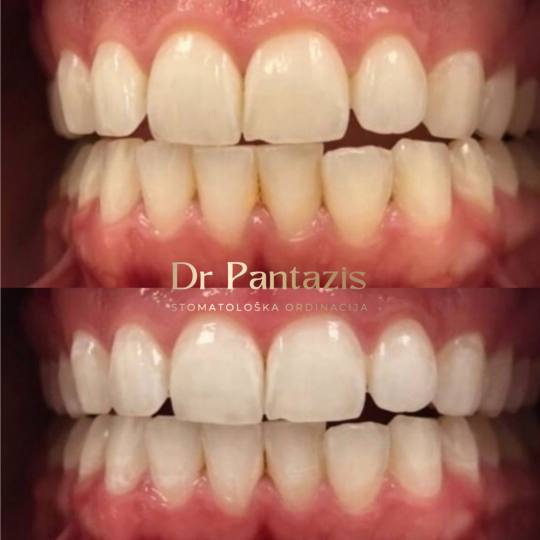 Dr Pantazis - Dental & Beauty Clinic #beograd