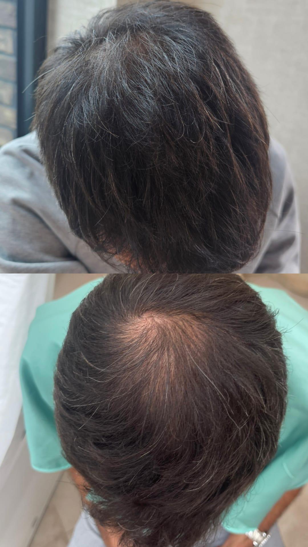 Choco Love #beograd Tretmani tela Hair Boost tretman za kožu glave i kose - Green Peel