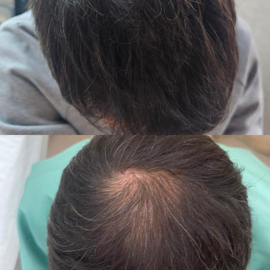 Choco Love #beograd Tretmani tela Hair Boost tretman za kožu glave i kose - Green Peel Green Peel H