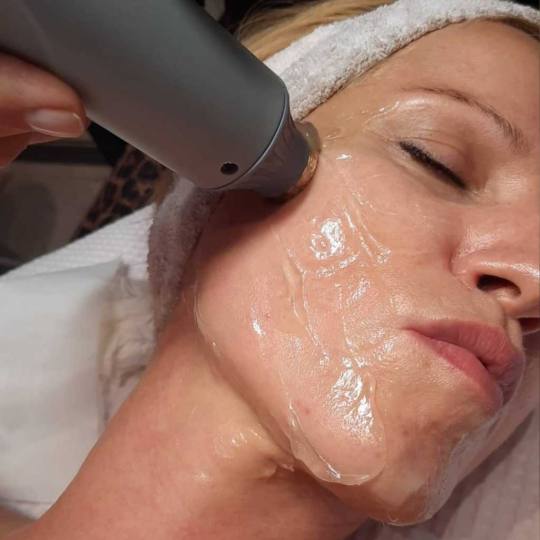 Grossi cosmetic #beograd Radiotalasni lifting zateže opuštenu kožu