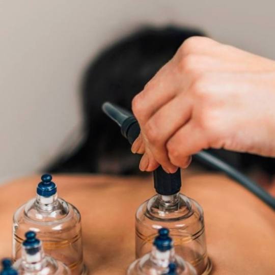 Glow Holistic Studio #beograd Anticelulit Cupping tretman - ventuze Terapija čašama je drevna kine