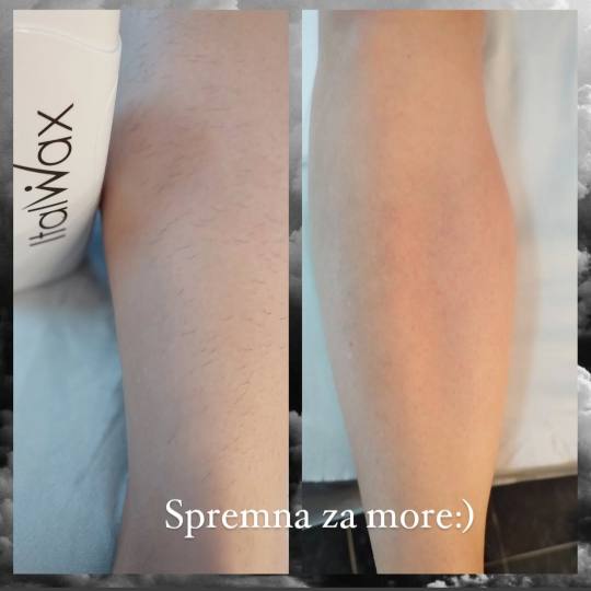 Leonis Beauty Premium #beograd