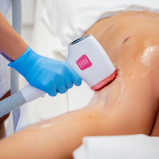 Monika Barta Cosmetics - Subotica #subotica Laserska epilacija Laserska epilacija gornjeg dela tela 