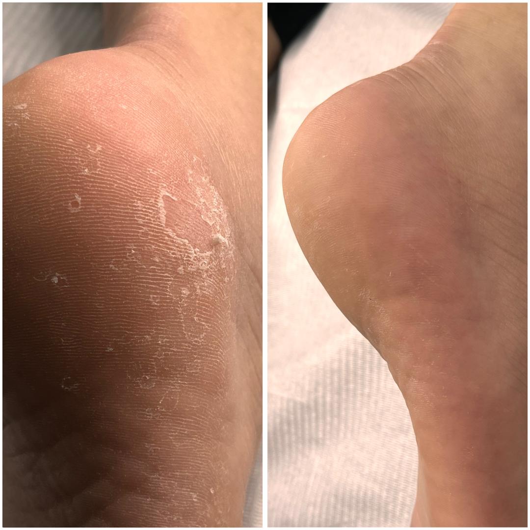 Belle Ana #beograd Estetski pedikir Ruski pedikir