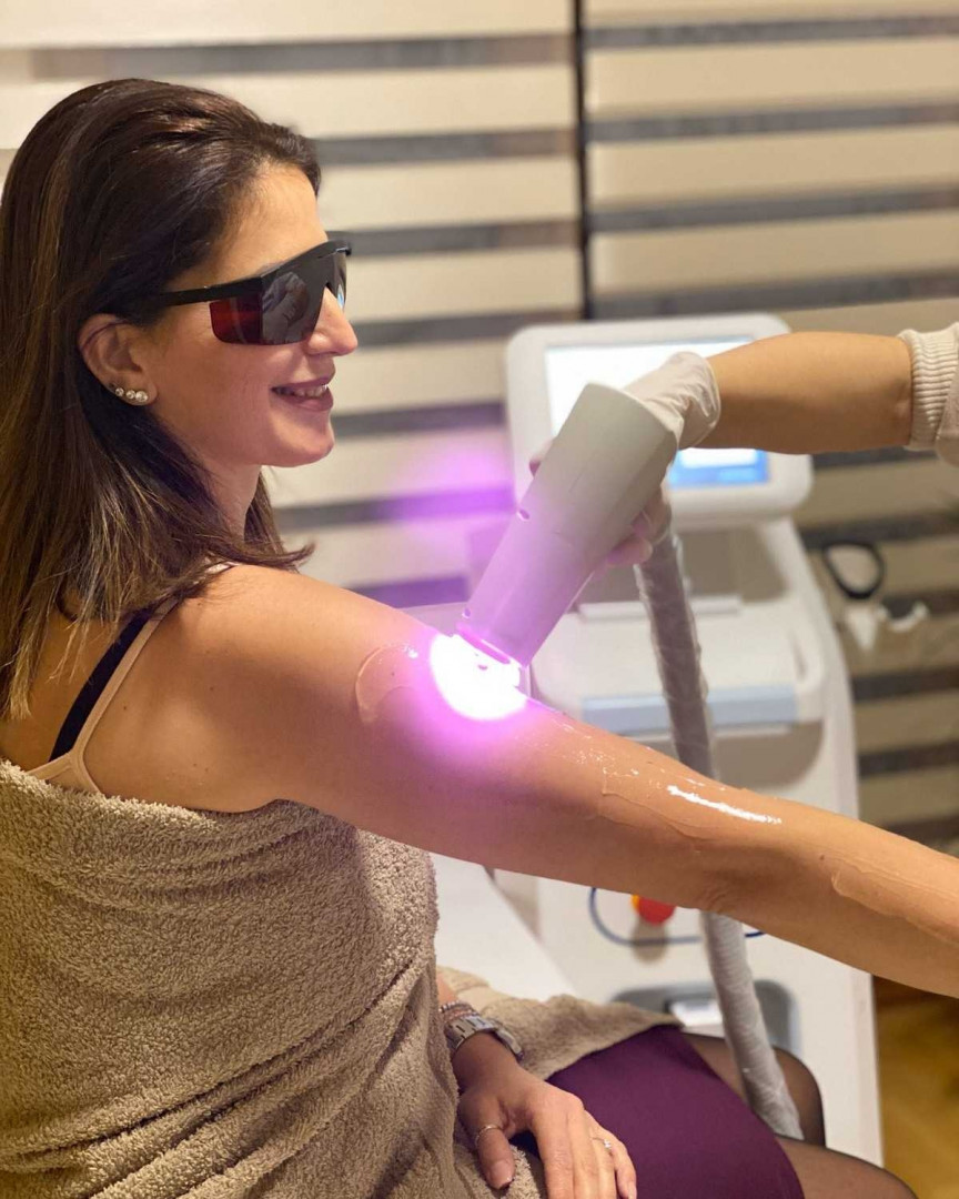 D&D Beauty Center #beograd Laserska epilacija Laserska epilacija celih ruku - za dame