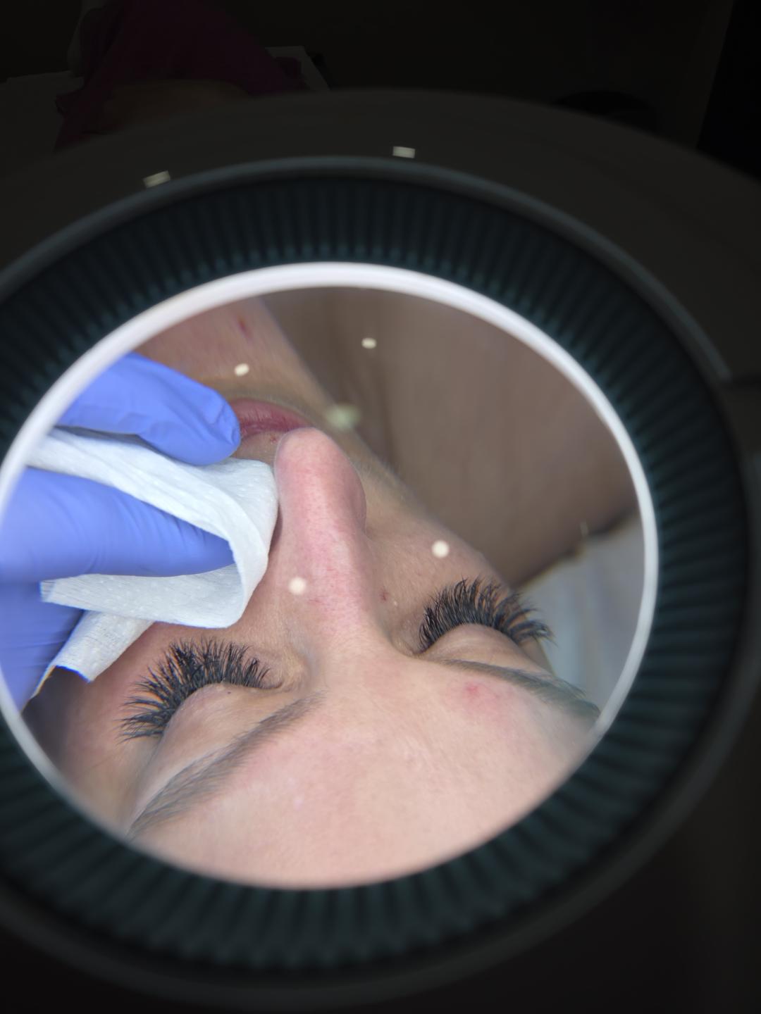 Klasičan tretman lica - Starmedic, Beograd Tretman lica Lice Tretman lica, Beograd, Vračar, Čubura, Crveni krst