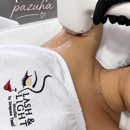 Lash & Light Studio #beograd Laserska epilacija Laserska epilacija pazuha - za dame Epilacija pazuha