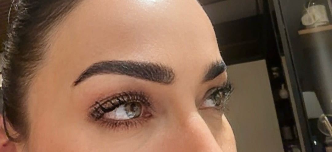 Brow lift - Studio Benvenuto, Beograd Obrve Lice Obrve, Beograd, Voždovac