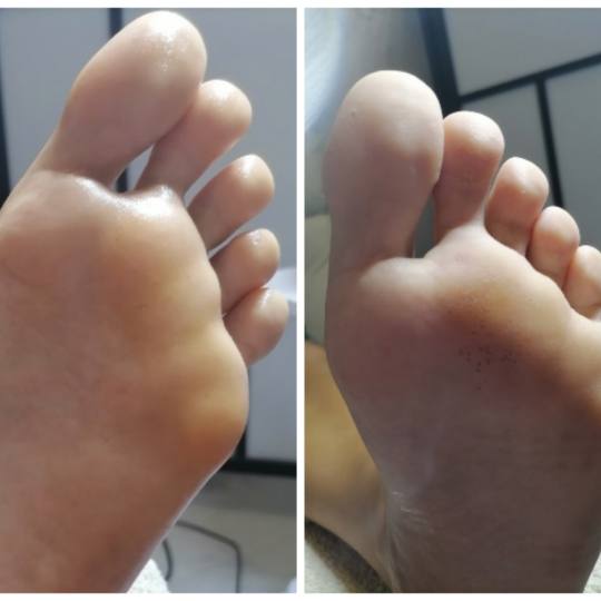 Dunja beauty 022 #novisad Estetski pedikir Estetski pedikir