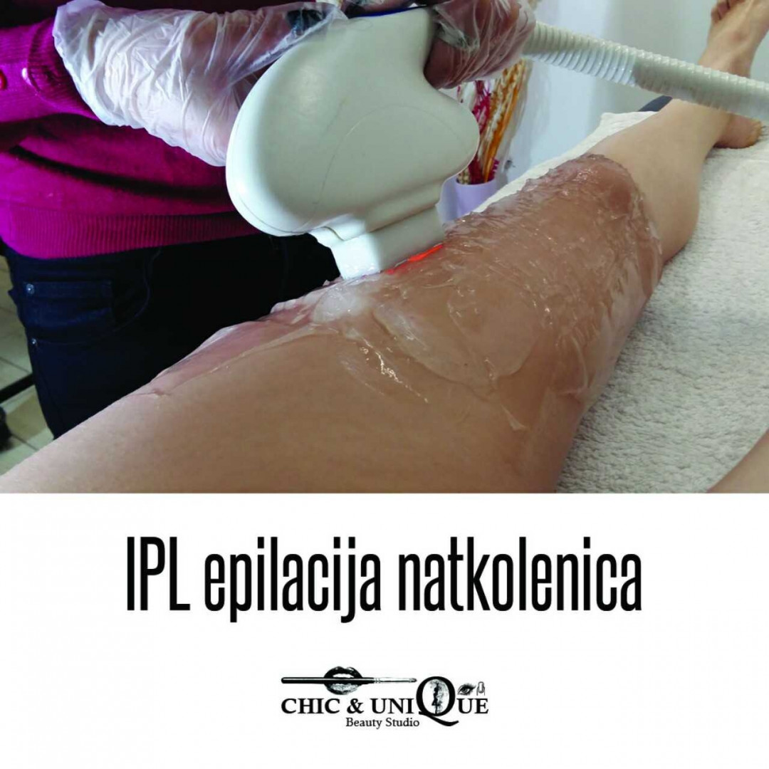Chic & Unique #beograd Epilacija IPL aparatom