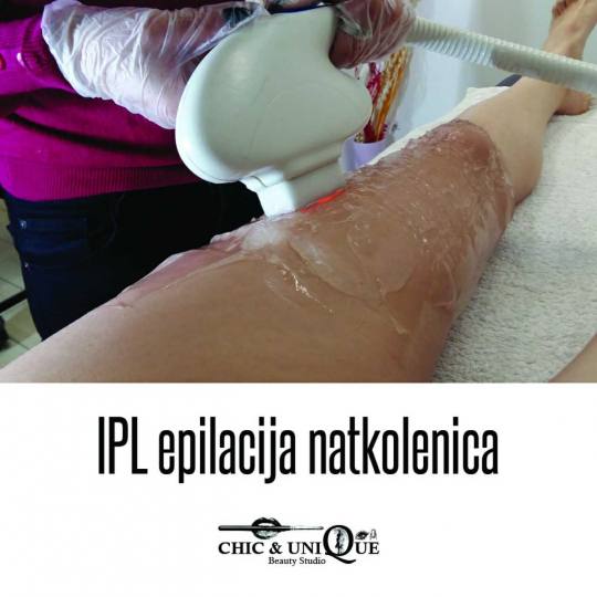 Chic & Unique #beograd Epilacija IPL aparatom