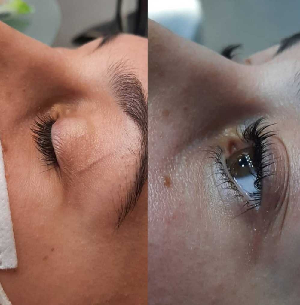 Grossi cosmetic #beograd Trepavice