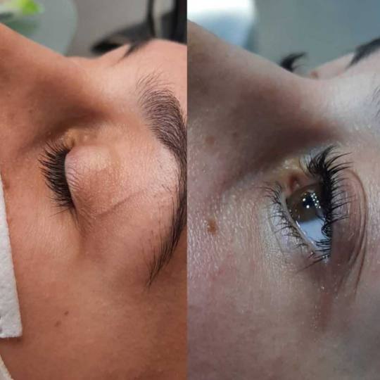 Grossi cosmetic #beograd Trepavice