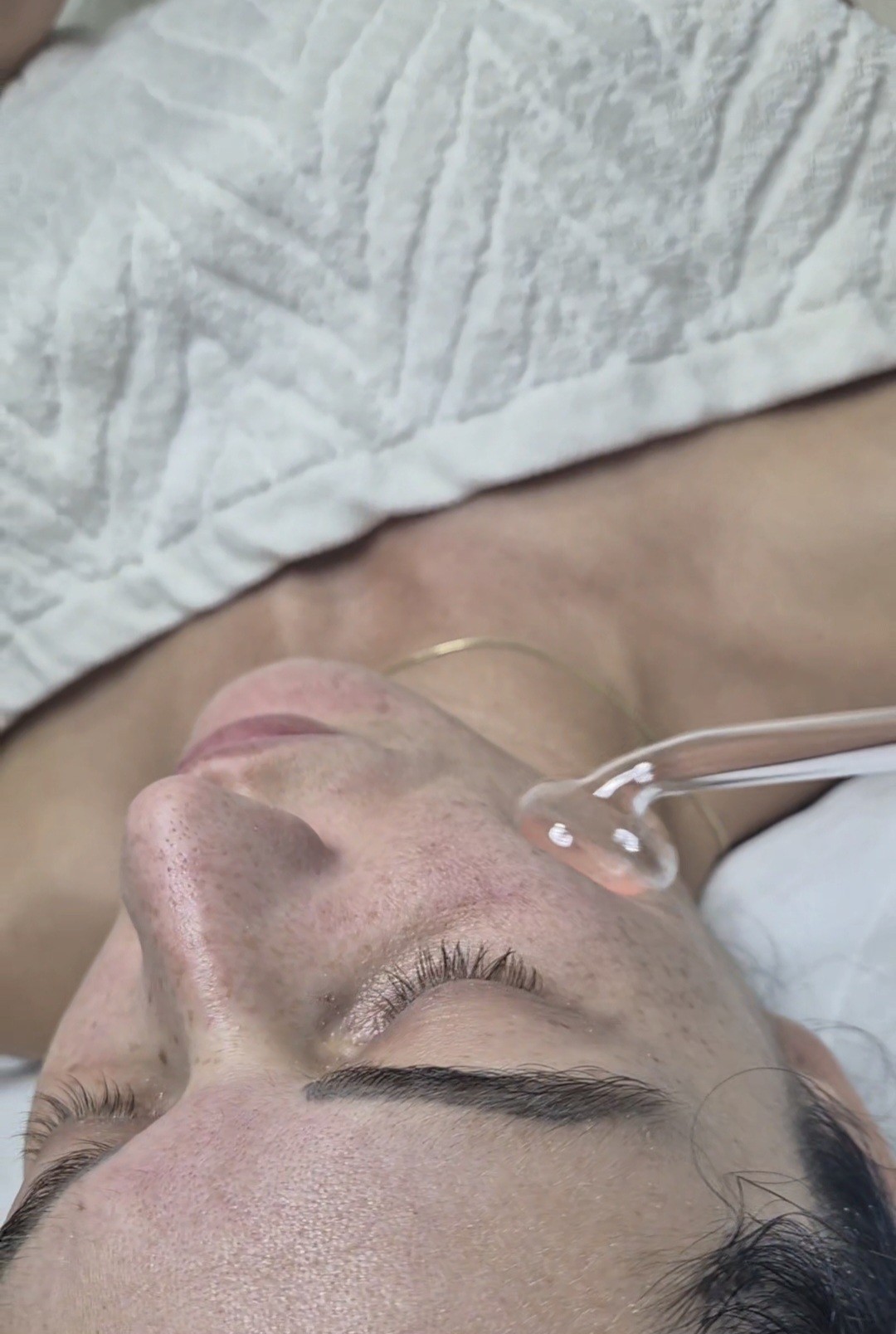 Beauty studio Venerino lice #novisad Tretman lica Higijenski tretman lica - komedoekspresija