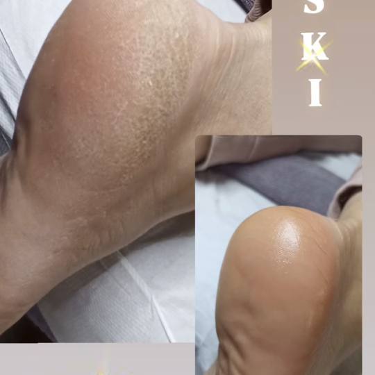 Aj Beauty Centar #pancevo Estetski pedikir Ruski pedikir