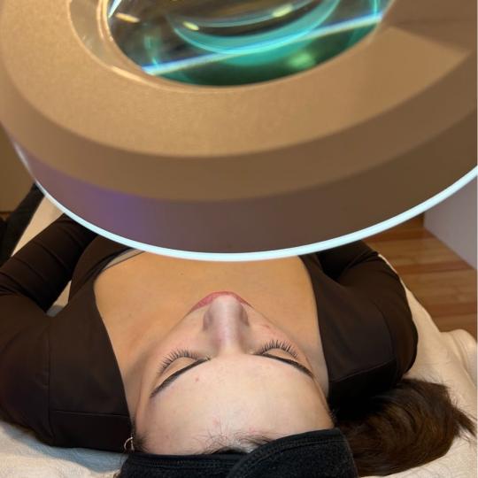 Esthetique Privé #beograd Tretman lica Higijenski tretman lica + dermapen