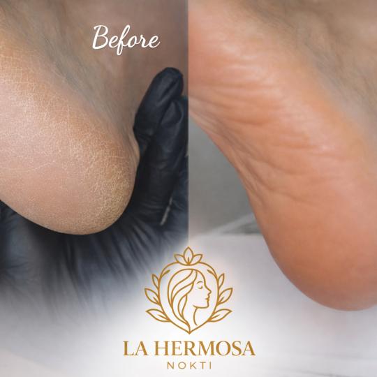 La Hermosa Beauty Studio #beograd Estetski pedikir Ruski pedikir