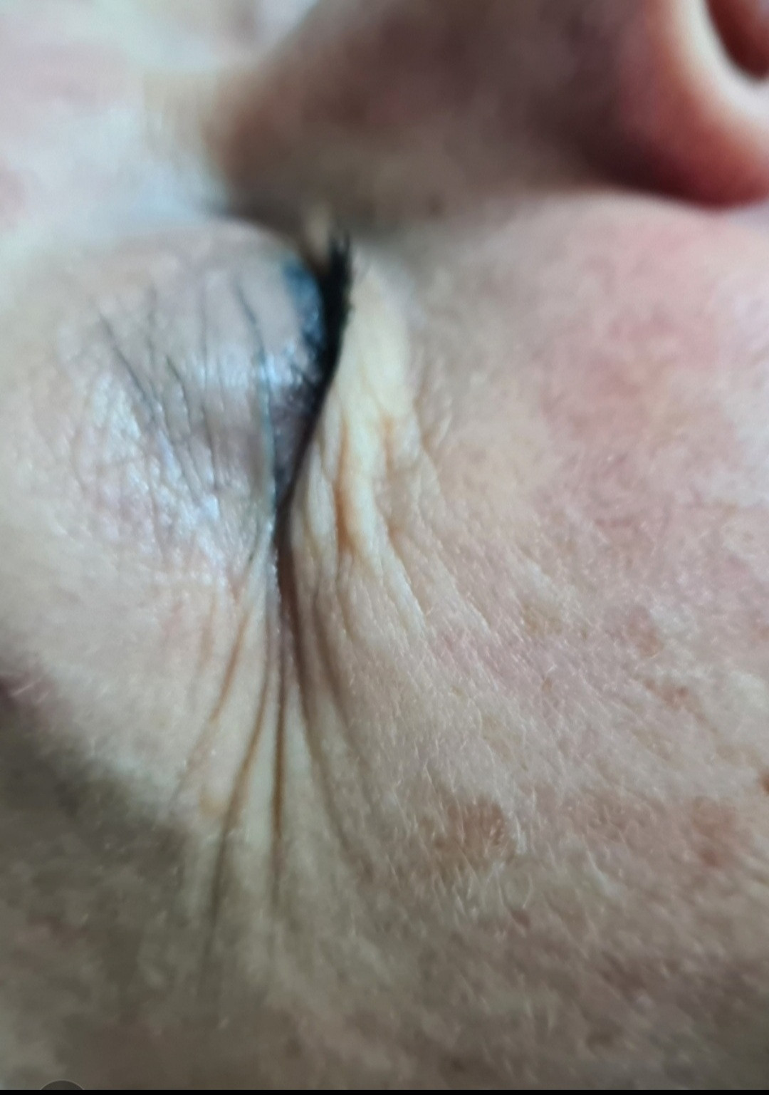 SunBox #beograd Masaža lica Face gym / Face fitness - anti age masaža lica