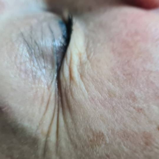 SunBox #beograd Masaža lica Face gym / Face fitness - anti age masaža lica