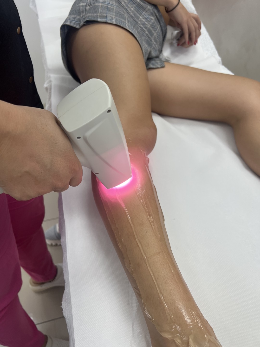 GM Beauty studio #beograd Laserska epilacija Laserska epilacija celih nogu - za dame